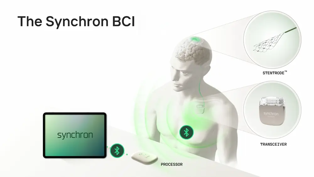 Synchron Stentrode brain implant electrodes a1